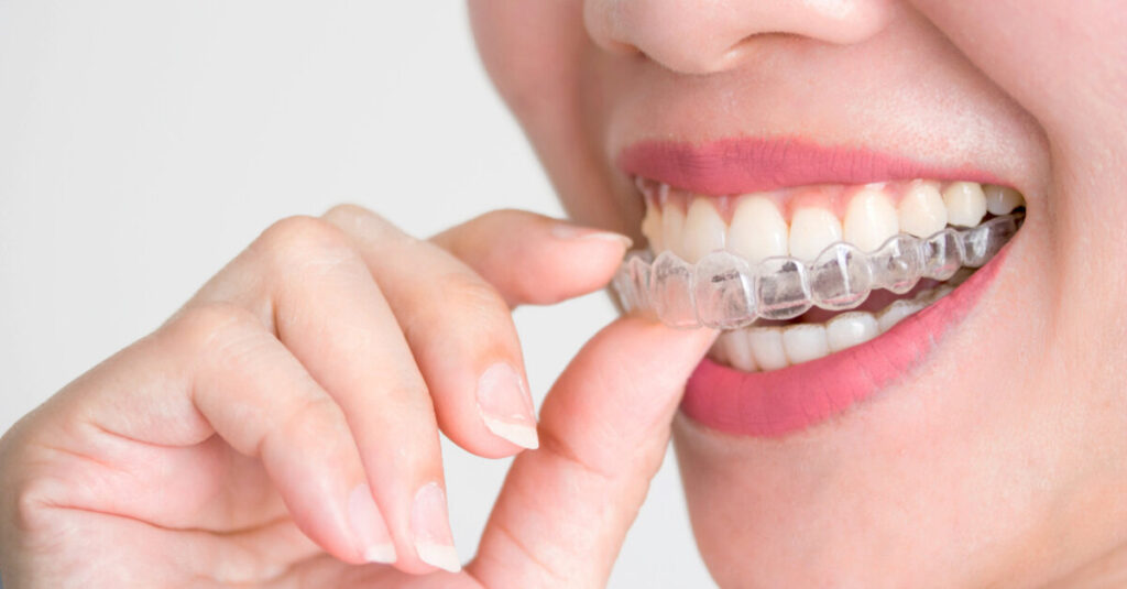 Behind Every Successful Braces Journey: An Experienced Orthodontist