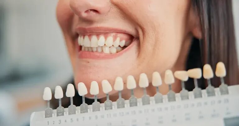 How Modern Dental Implants Are Transforming Smiles