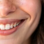 How Quality Lip Filler Treatments Can Improve Facial Symmetry and Confidence