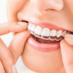 How Dental Implants Can Restore Your Smile and Confidence