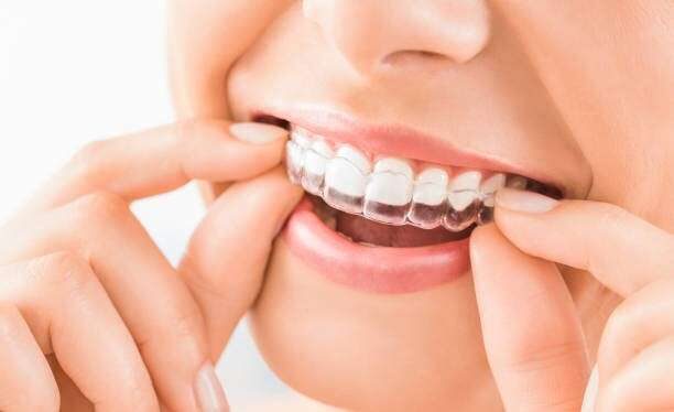 How Dental Implants Can Restore Your Smile and Confidence